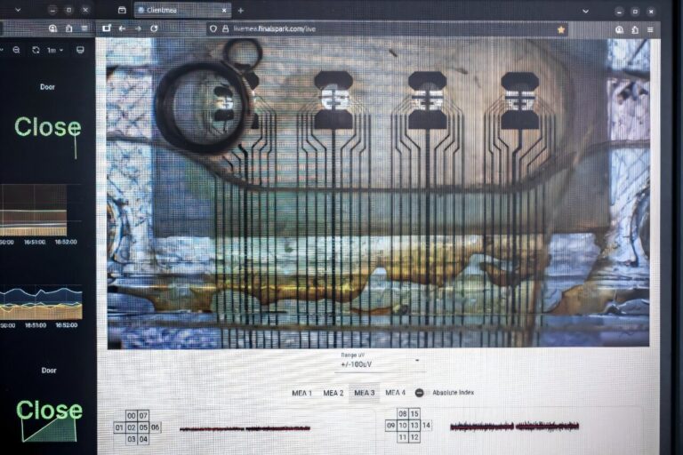 Yet another solution for universal expansion; computing with brain organoids